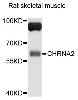CHRNA2 Antibody