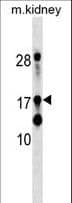 DR1 / NC2 Antibody (aa83-112)