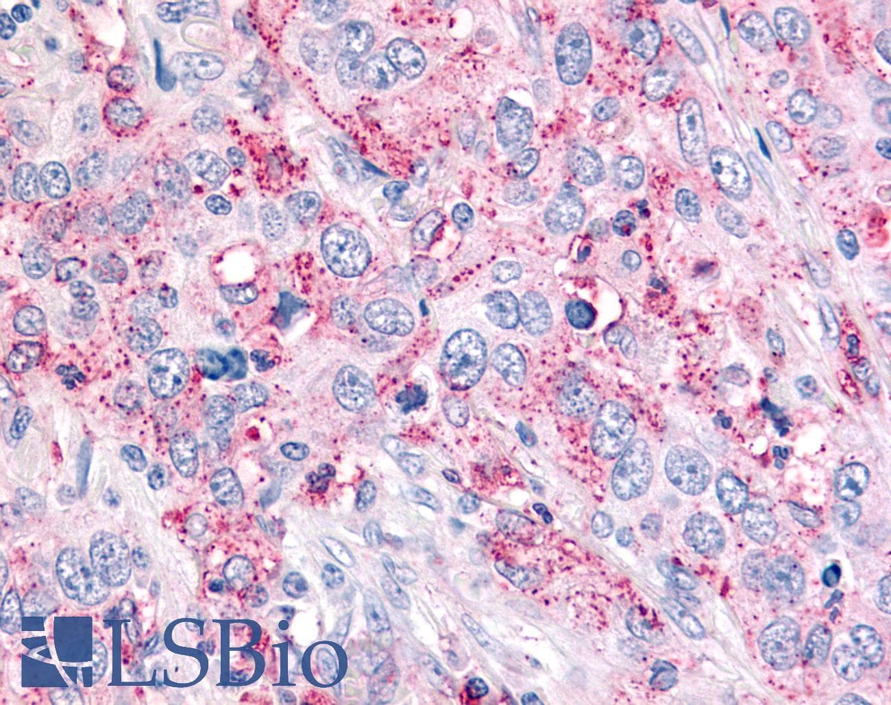 IHC-plus™ Polyclonal Rabbit anti-Human USP4 Antibody (N-Terminus, IHC, WB)