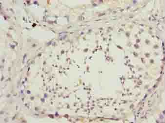 DNAL4 / Dynein Light Chain 4 Antibody