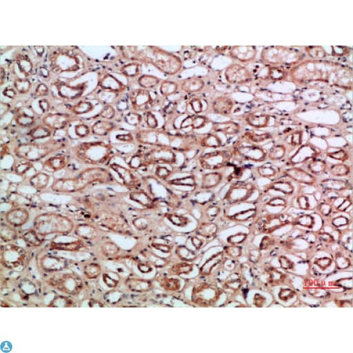 CLEC3B / Tetranectin Antibody