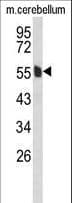 PALS2 / MPP6 Antibody (aa360-388)