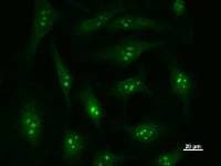 DDX27 Antibody (clone 2251C2a)