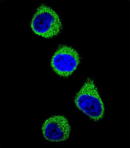 Polyclonal Rabbit anti-Human MTHFD1 Antibody (aa535-562, IHC, IF, WB)