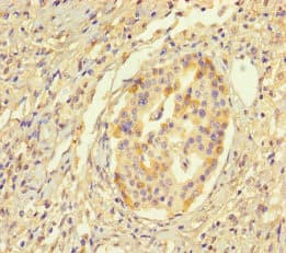 Polyclonal Rabbit anti-Human HYPM / CXorf27 Antibody