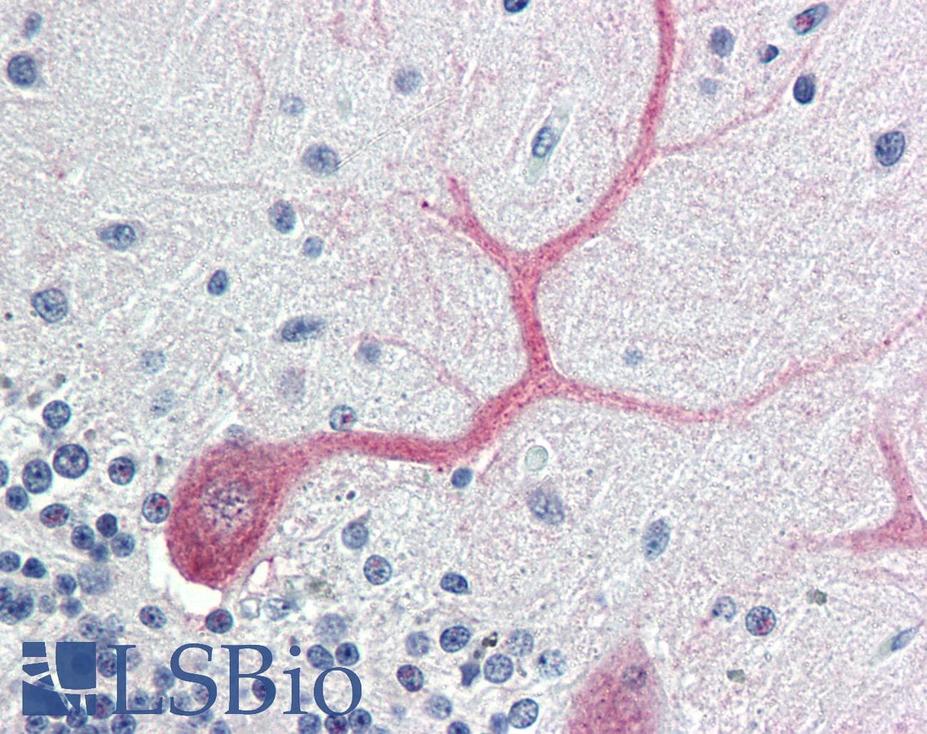IHC-plus™ BIRC7 / Livin Antibody
