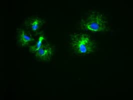 KRT18 / CK18 / Cytokeratin 18 Antibody (clone OTI1E1)