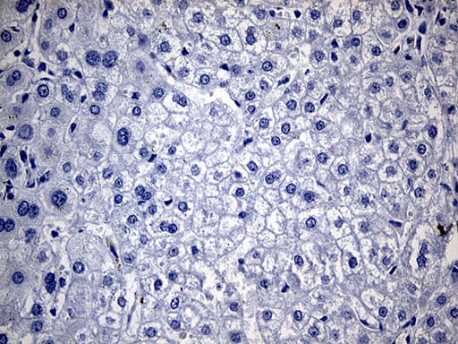 TG / Thyroglobulin Antibody (aa20-358, clone OTI8E1)
