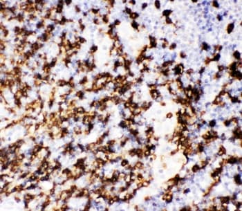 CD20 Antibody