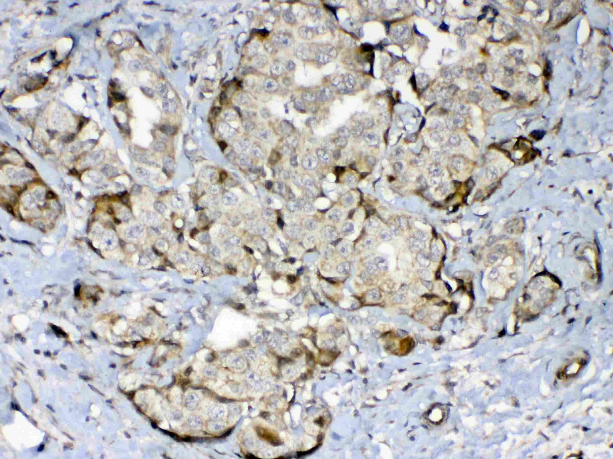 Polyclonal Rabbit anti-Human GAD65 Antibody (IHC, WB)