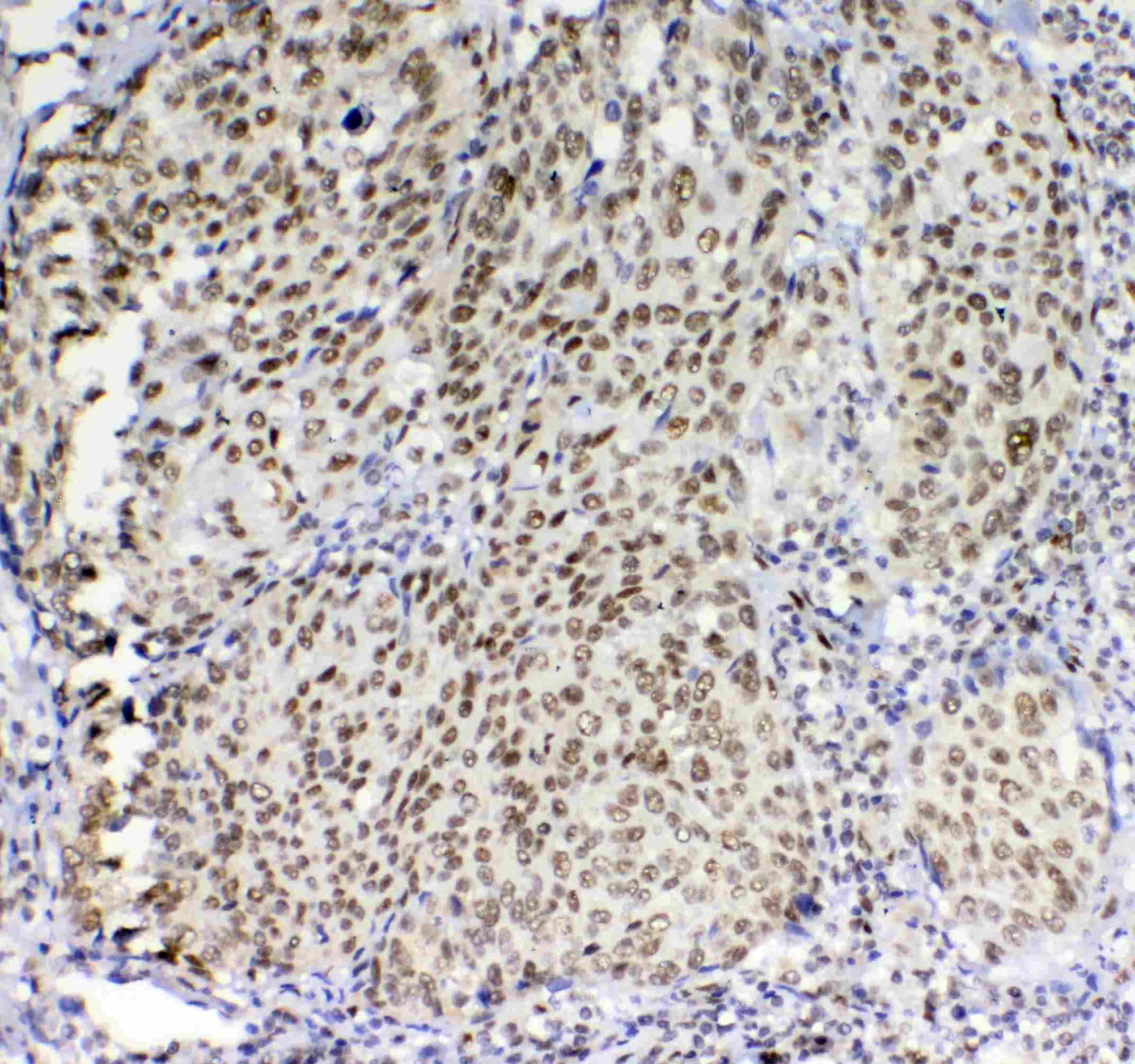 BLIMP1 / PRDM1 Antibody