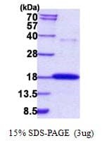 Human RNASE7 Protein (Recombinant His)