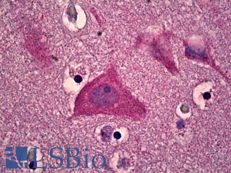 IHC-plus™ CAMKV Antibody (aa211-260)
