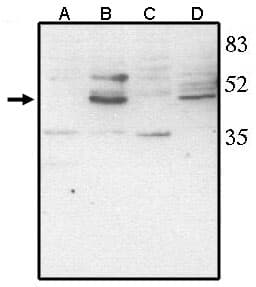 Polyclonal Sheep anti-Chicken VSX2 / CHX10 Antibody (WB)