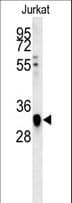 TFAP4 / AP-4 Antibody (aa306-334)
