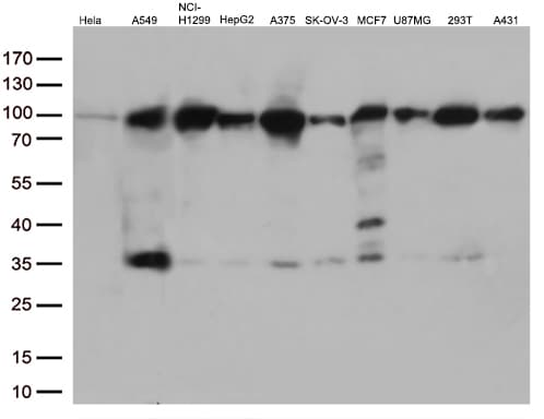 EWSR1 / EWS Antibody (aa256-447, clone OTI2G3)
