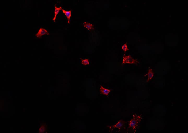 VIP Antibody
