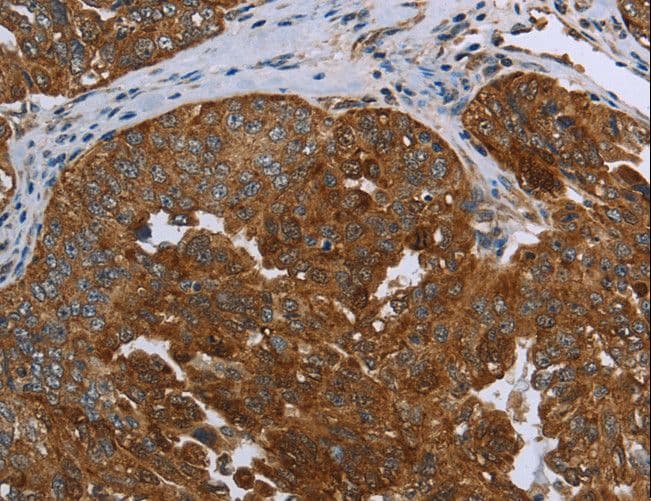 SNCG / Gamma-Synuclein Antibody