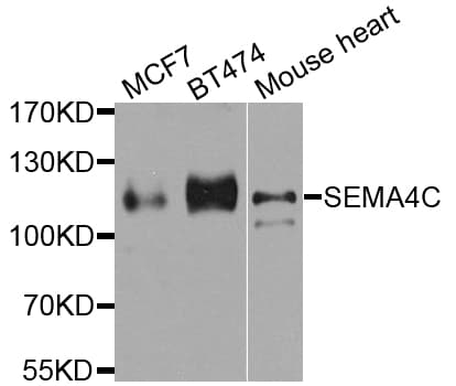 SEMA4C / Semaphorin 4C Antibody