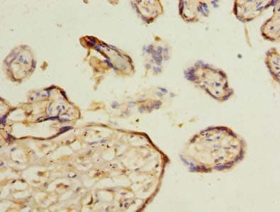 Polyclonal Rabbit anti-Human MLX / TCFL4 Antibody (IHC)