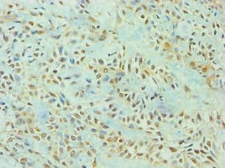 TP53I3 / PIG3 Antibody (aa163-332)