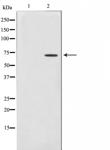 IVL / Involucrin Antibody