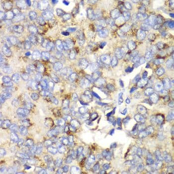 MtTFA / TFAM Antibody