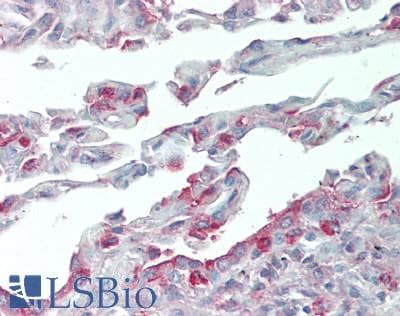 IHC-plus™ SLC34A2 / NaPi-2b Antibody (C-Terminus)