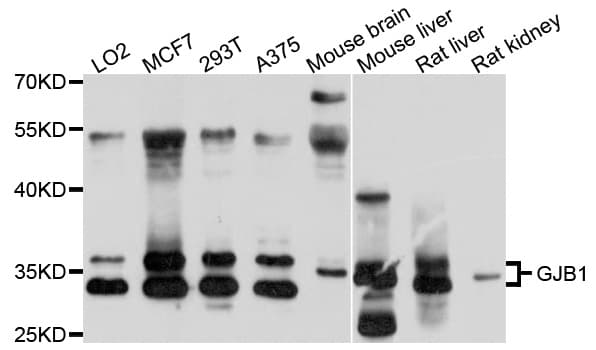 GJB1 / CX32 / Connexin 32 Antibody