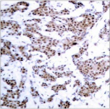 MEF2A / MEF2 Antibody