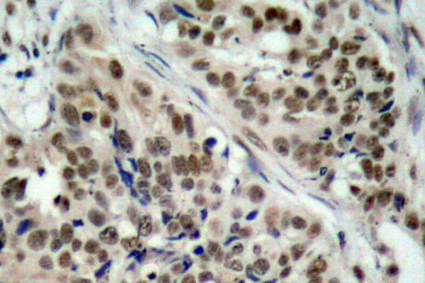 Polyclonal Rabbit anti-Human FOXO1 / FKHR Antibody (phospho-Ser256, IHC, IF, WB)