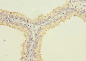 Polyclonal Rabbit anti-Human SLC6A15 / SBAT1 Antibody (IHC, IF)
