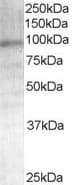 Polyclonal Goat anti-Human AR / Androgen Receptor Antibody (aa2-16, IHC, IF, WB)