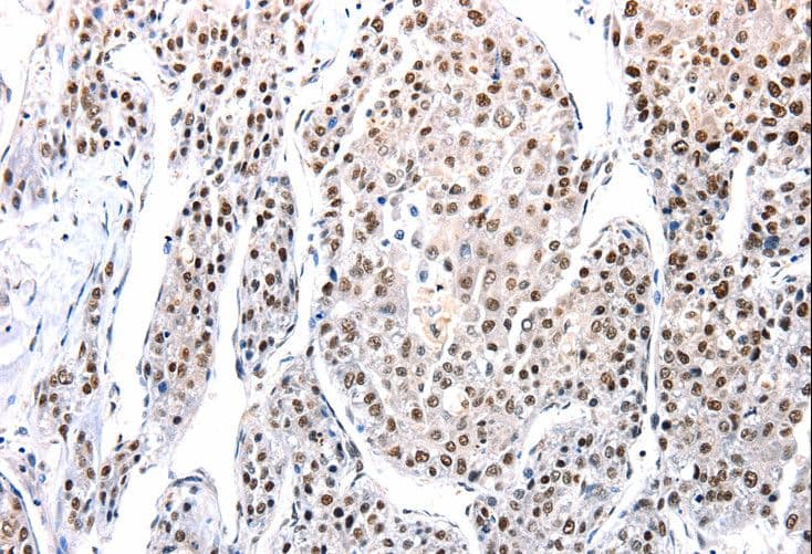Polyclonal Rabbit anti-Human AQP2 / Aquaporin 2 Antibody (IHC)