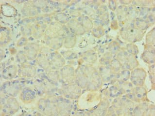 PDLIM1 Antibody (aa1-329)