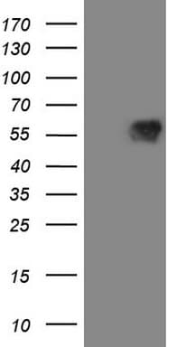 VISA / MAVS Antibody (aa1-247, clone OTI9C4)
