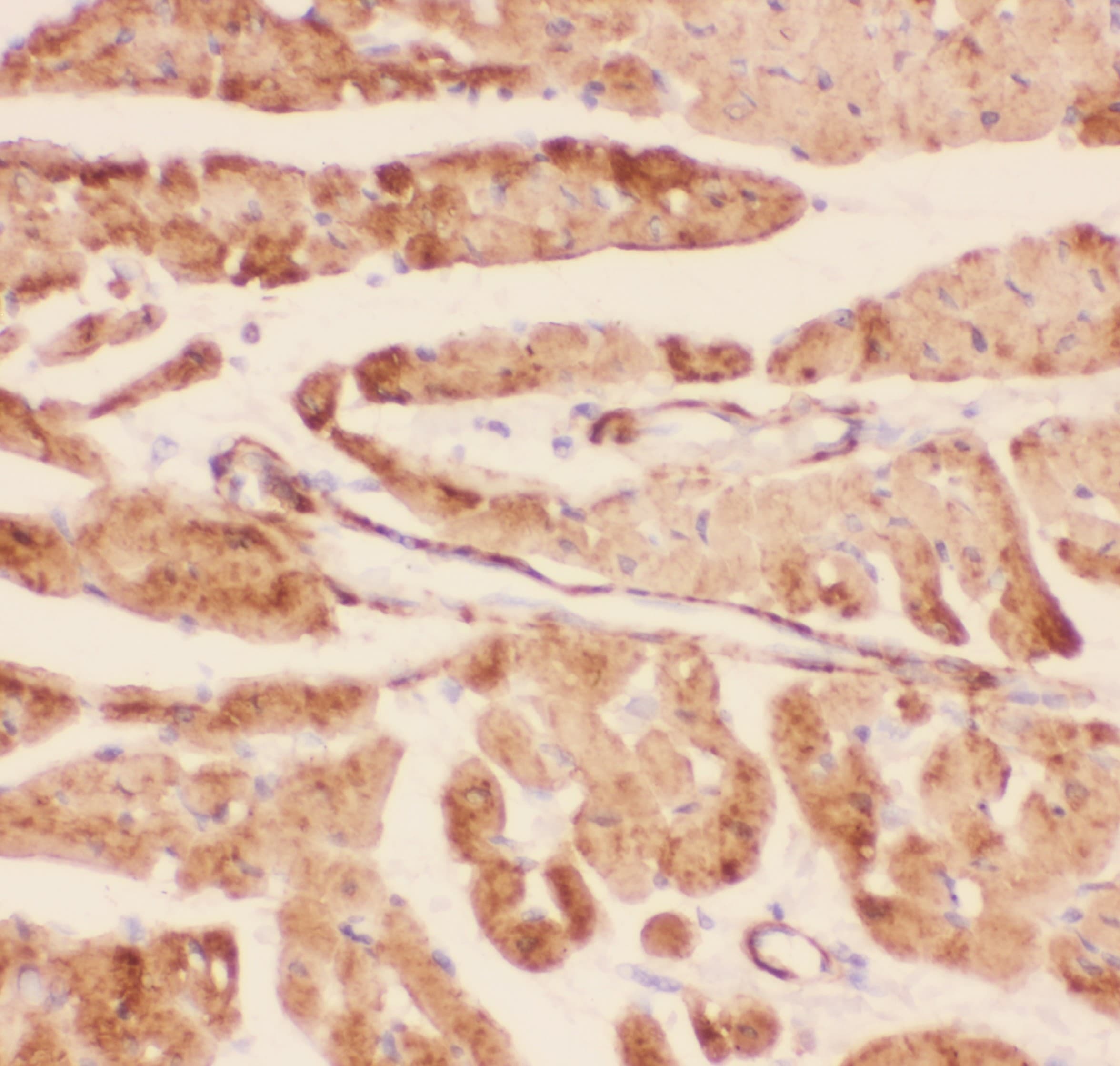 Polyclonal Rabbit anti-Human DES / Desmin Antibody (aa1-304, IHC, WB)
