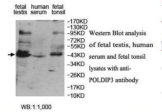Polyclonal Rabbit anti-Human POLDIP3 / p46 Antibody (aa4-149, IHC, WB)