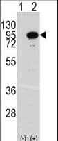 ACO2 / Aconitase 2 Antibody (aa294-325)