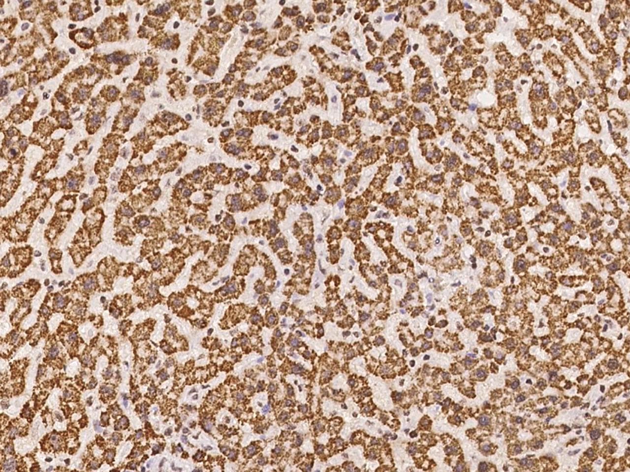 GLYATL1 Antibody