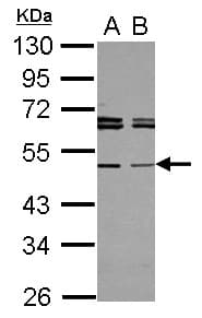 TAPBPL / TAPBPR Antibody