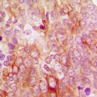 SLC16A12 / MCT12 Antibody (Internal)