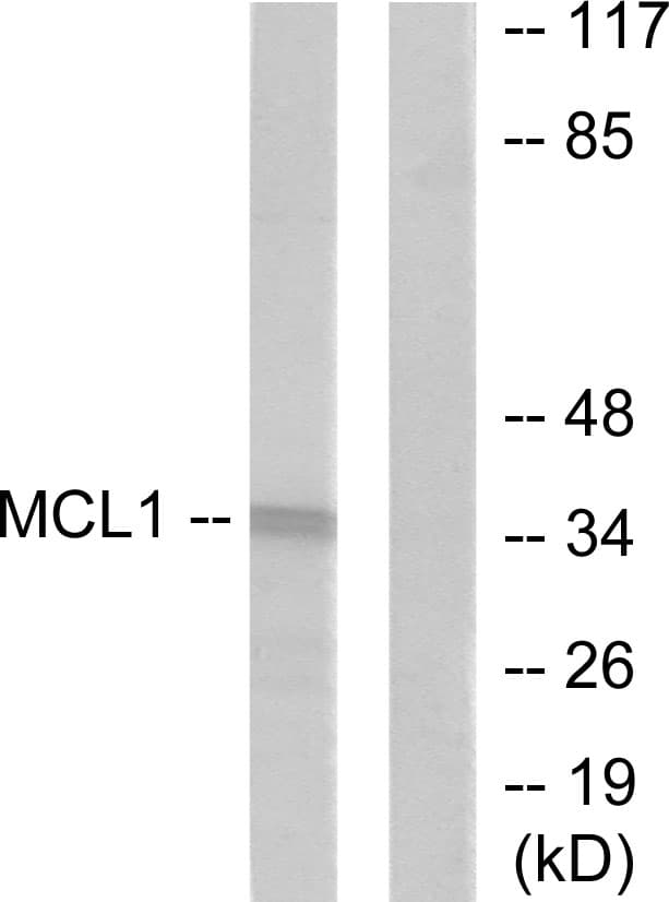 MCL1 / MCL 1 Antibody (aa91-140)