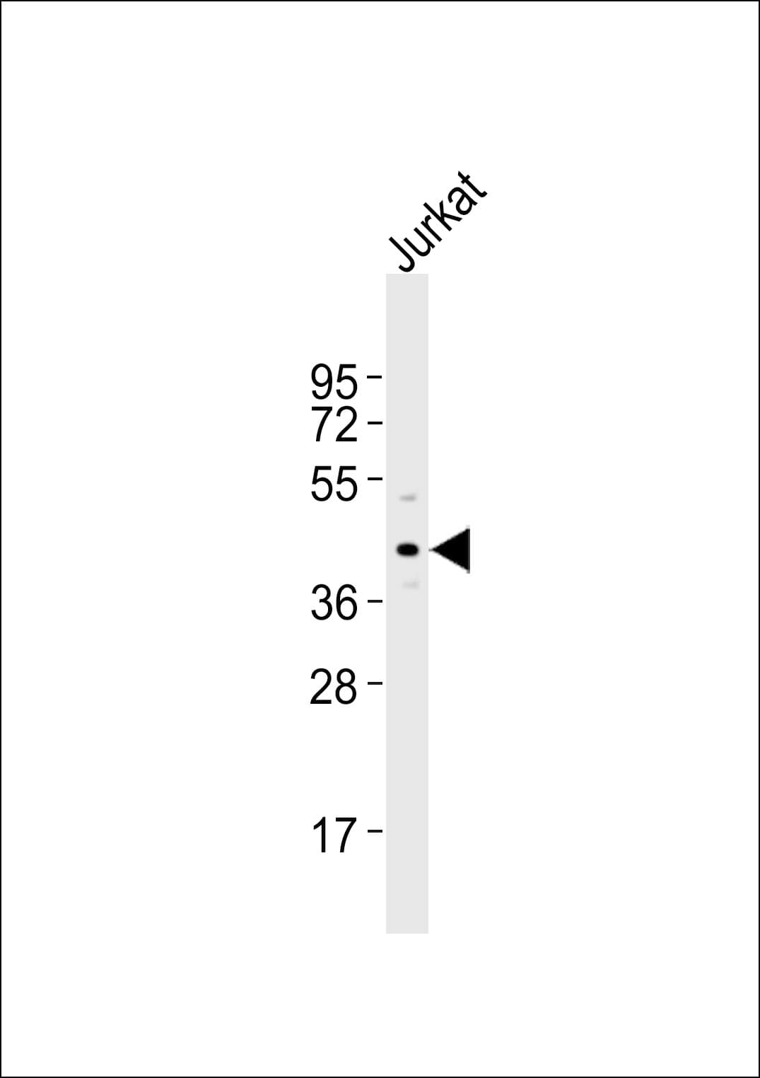 Polyclonal Rabbit anti-Human TPRA1 / GPR175 Antibody (WB)