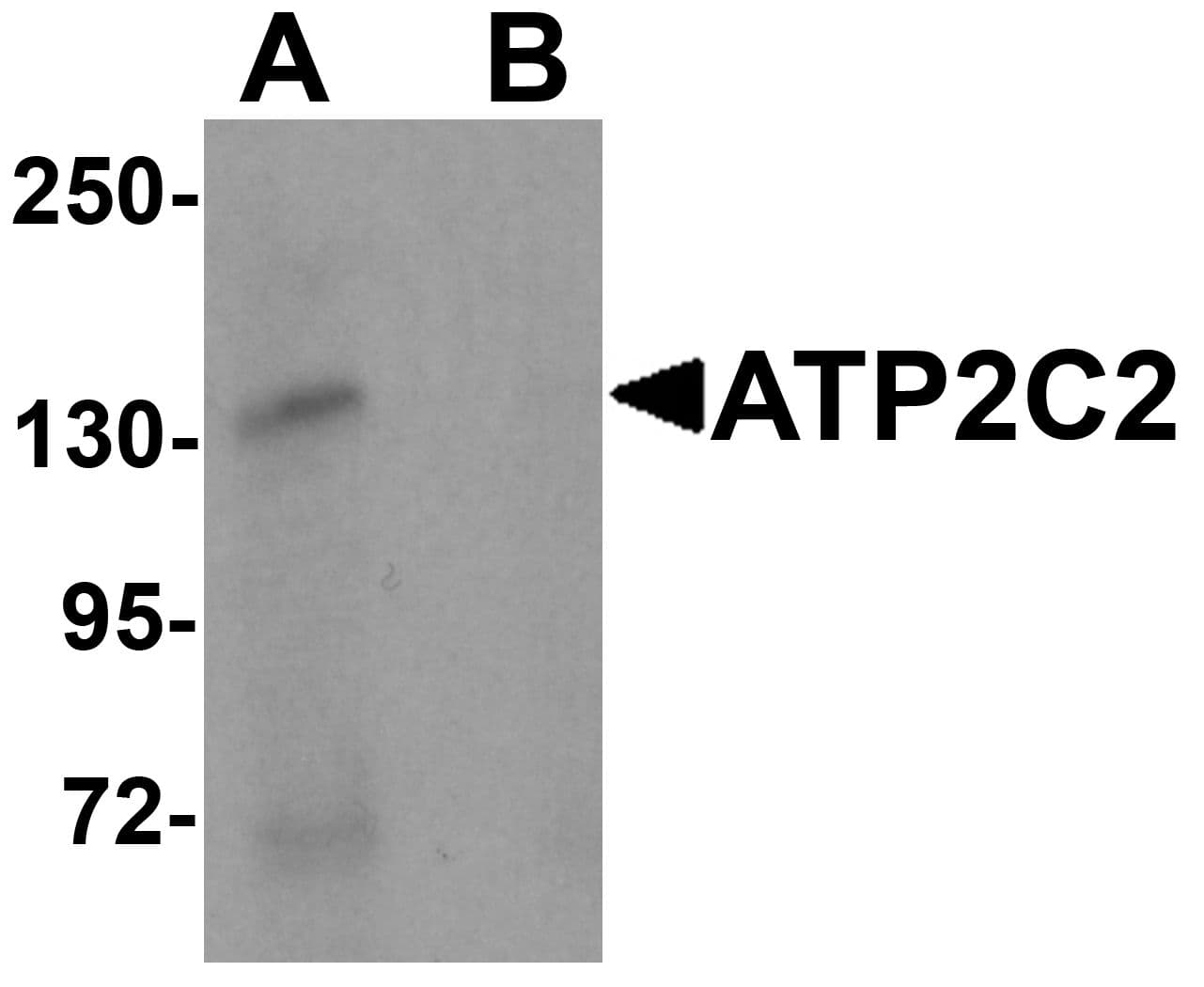 Polyclonal Rabbit anti-Human KIAA0703 / SPCA2 Antibody (IF, WB)