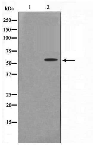 Polyclonal Rabbit anti-Human TKFC / DAK Antibody (WB)