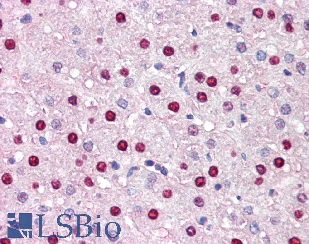 IHC-plus™ KDM5C / Jarid1C / SMCX Antibody (C-Terminus)