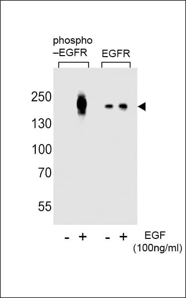 Polyclonal Rabbit anti-Human EGFR Antibody (phospho-Tyr1016, WB)
