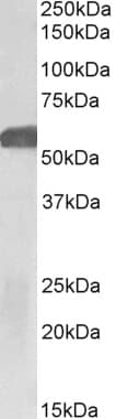 GLP1R / GLP-1 Receptor Antibody (aa211-222)