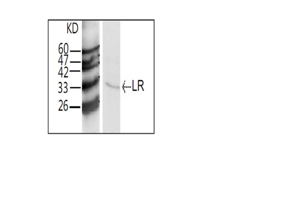 RPSA / Laminin Receptor Antibody
